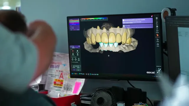 A digital design of a full set of teeth on a computer screen.
