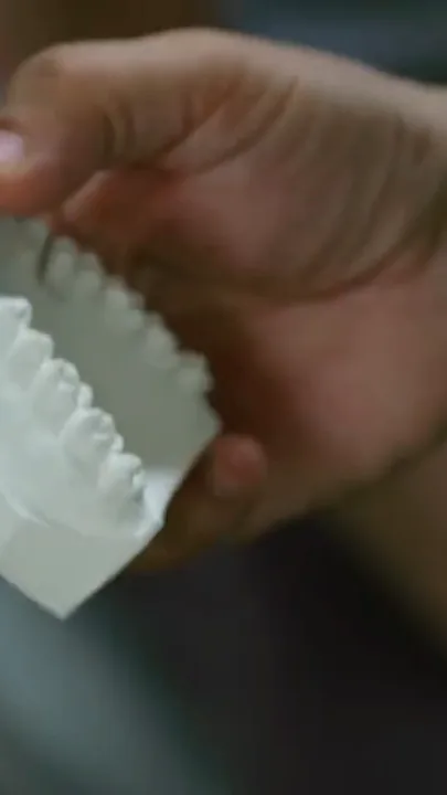 Hands holding a white dental model.